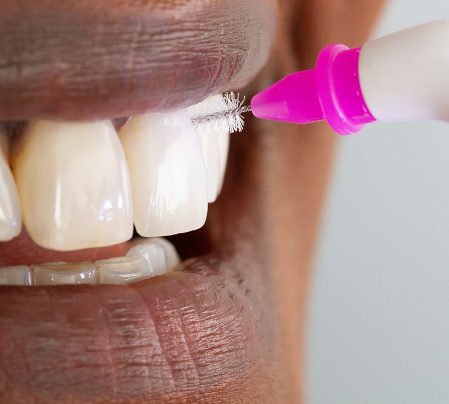 Soin d'hygiène des gencives, brossette interdentaire