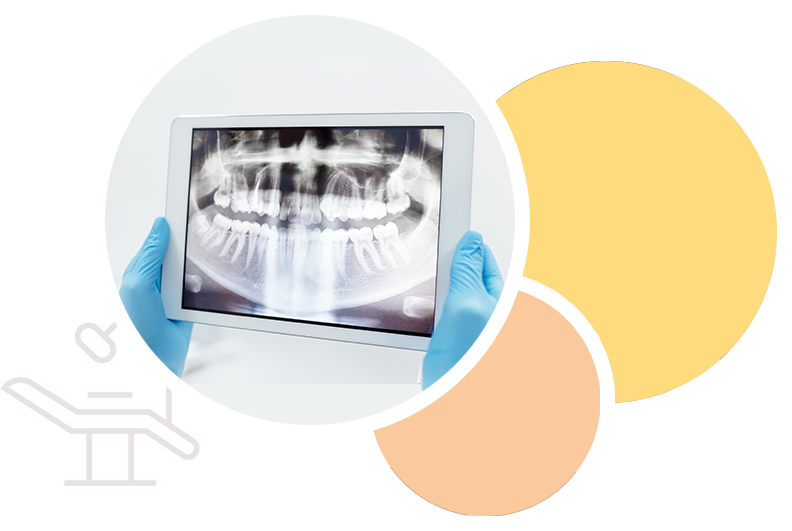 Radiographie panoramique dentaire consultée sur tablette